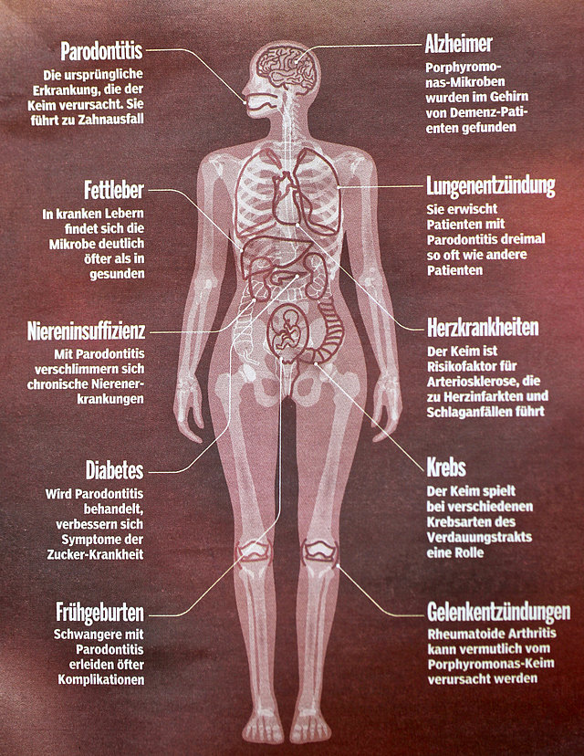 Bakterien können vom Mund aus den Körper besiedeln und krank machen.