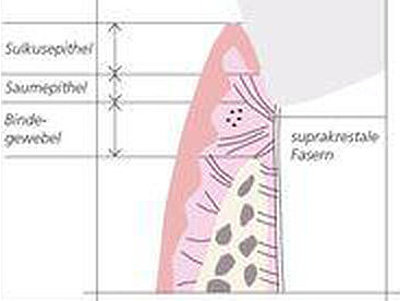 Abb.: Biologische Breite (mod. nach Lindhe 2005)