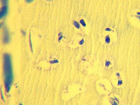 Histologie eines Bone Chips