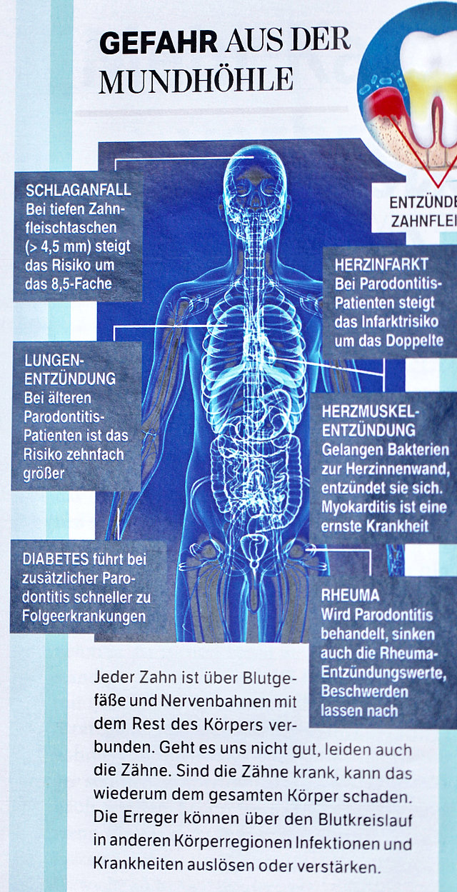 Gefahr aus der Mundhöhle