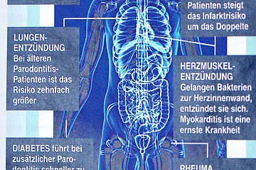 Gefahr aus der Mundhöhle