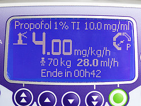 Narkoseüberwachung mit Injectomat