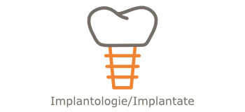 Implantologie/Implantate